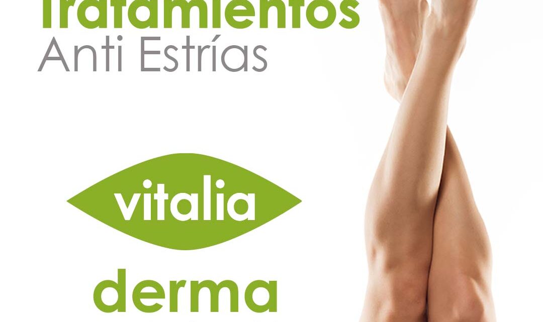 Estrias Tratamiento