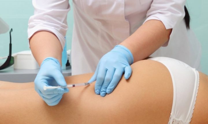 carboxiterapia19